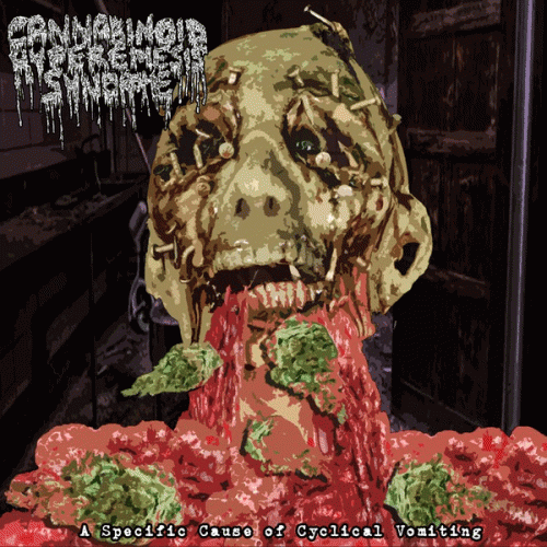 Cannabinoid Hyperemesis Syndrome : A Specific Cause of Cyclical Vomiting